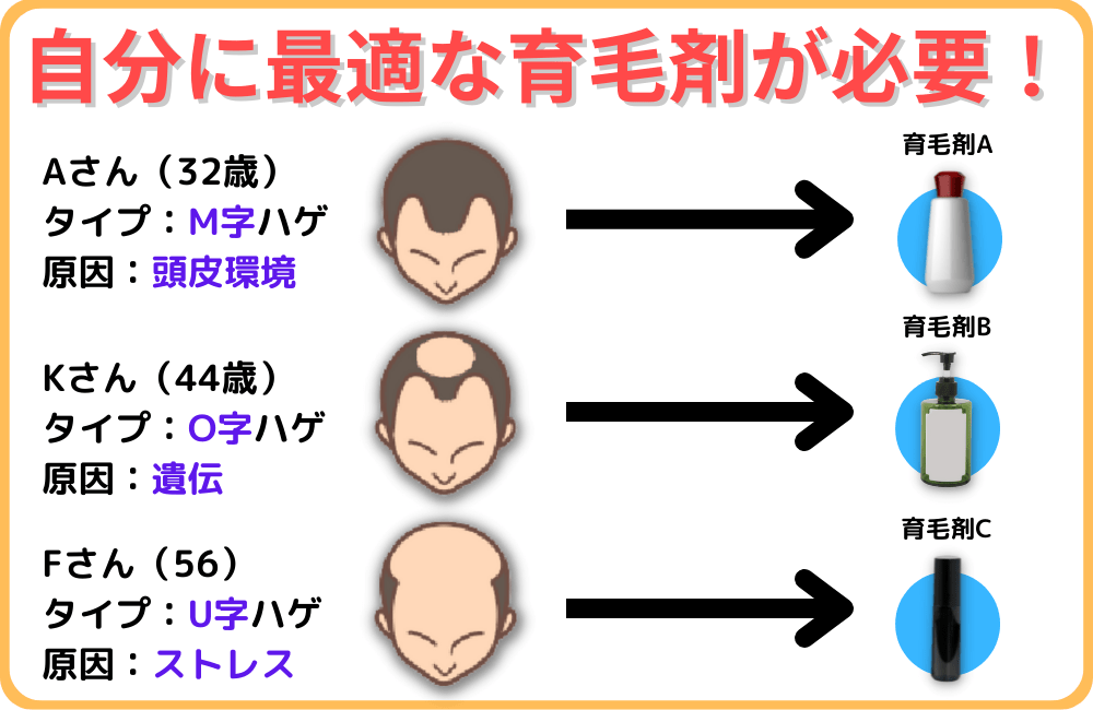 1人1人に合わせた専用育毛剤が不可欠